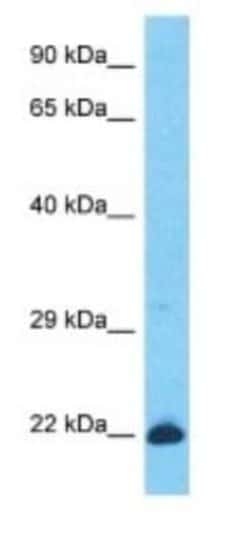 KRTAP26-1 Rabbit anti-Human, Polyclonal, Novus Biologicals:Antibodies:Primary